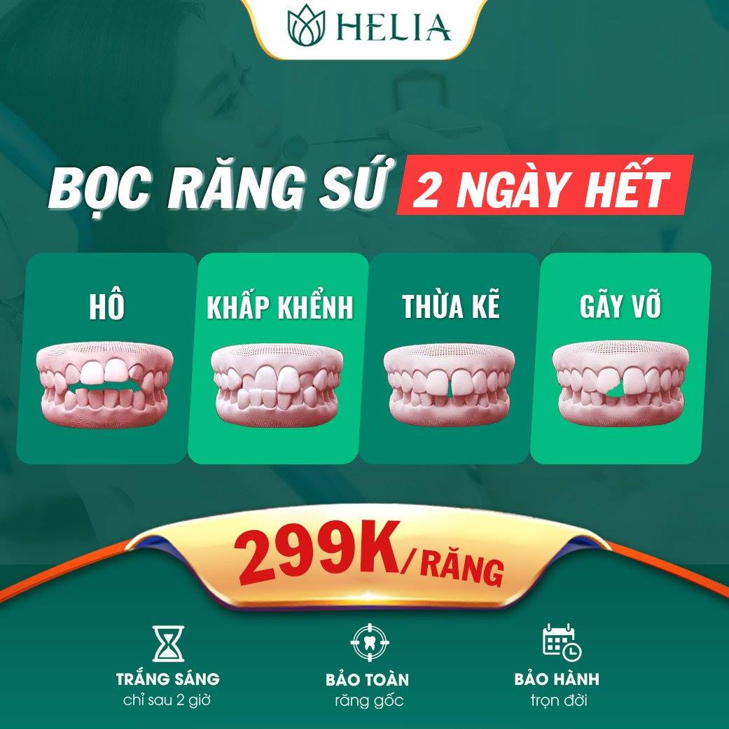 Bọc răng sứ: Ưu - Nhược điểm cần chú ý