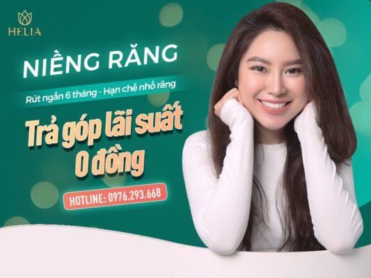 Niềng răng trả góp tại HELIA