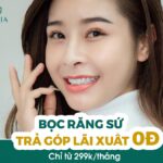 Bọc sứ trả góp tại HELIA chỉ từ 299k